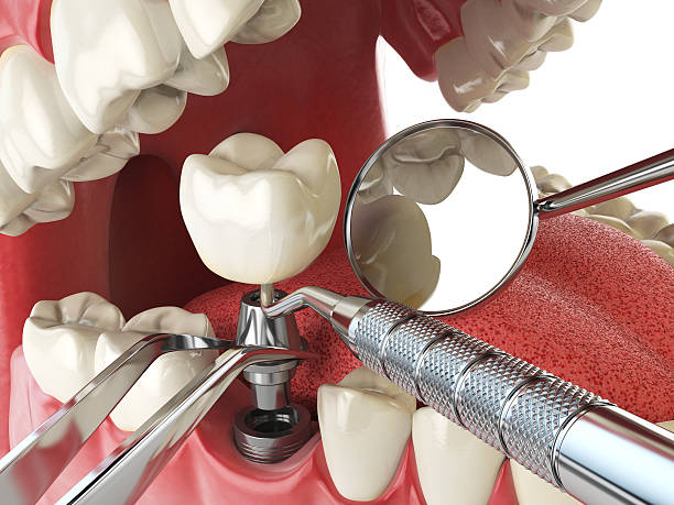 Best Emergency Denture Repair in Paintsville, KY